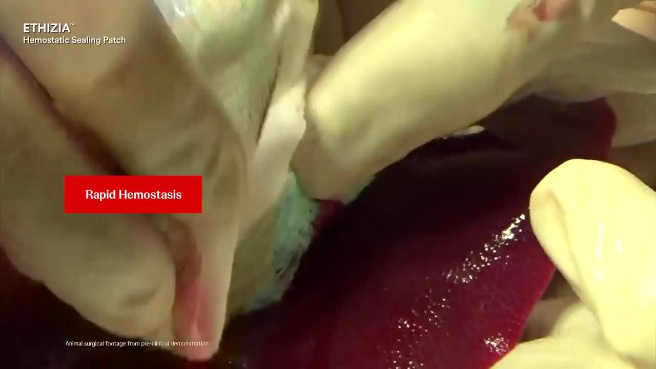 ETHIZIA Testimonial Dewilt