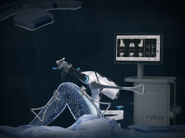 VELYSTM Robotic-Assisted Solution