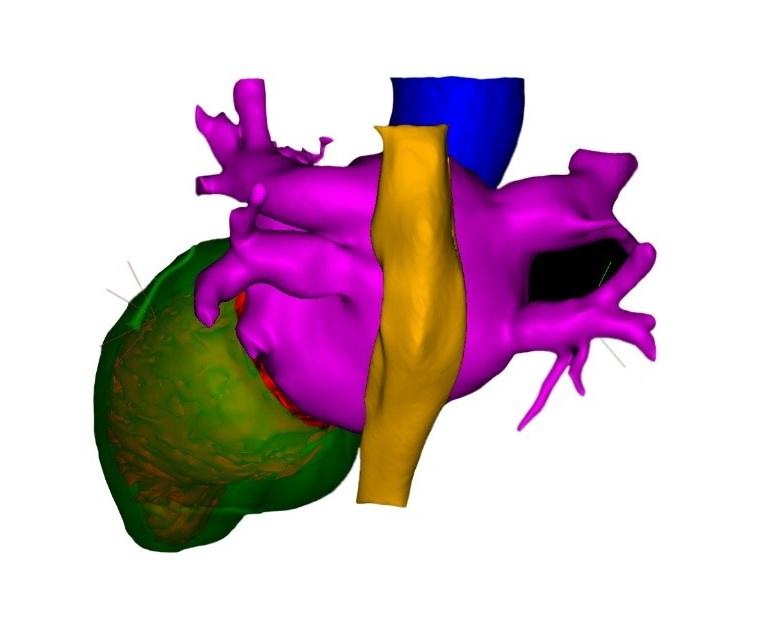 CARTOSEG™ CT Module