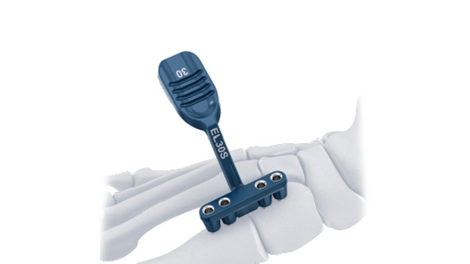 BME ELITE Drill Guide kit used to determine implant bridge size and configuration for hallux valgus deformity correction.