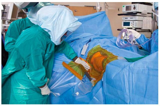 Figure 6 cover skin with iodine incise drape,