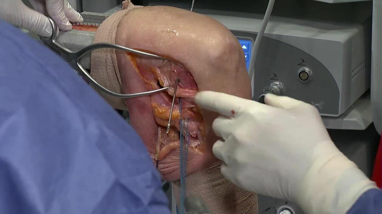 Dr. Ciccone PLC with TIGHT-N Video