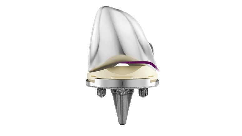 Front view of the ATTUNE™ Medial Stabilized Knee System with tibial base