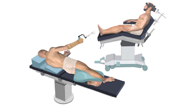 a diagram of a rotator cuff repair patient seated in a beach chair or lateral decubitus position