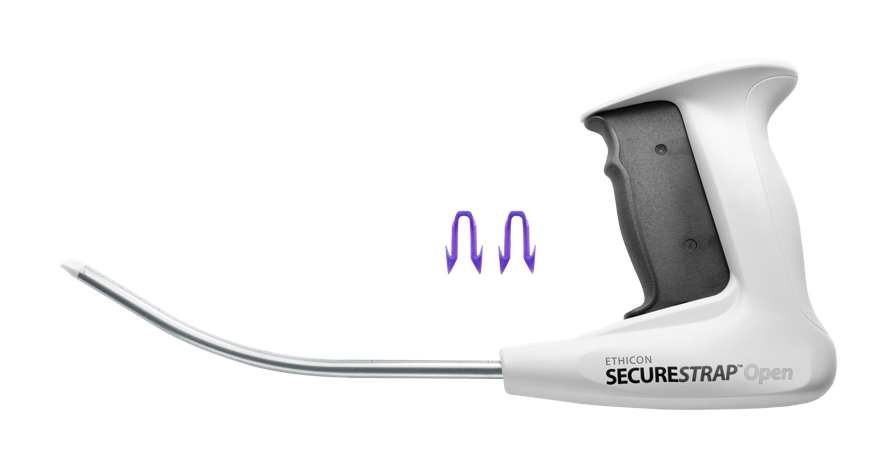 ETHICON SECURESTRAP® Open Absorbable Strap Fixation Device