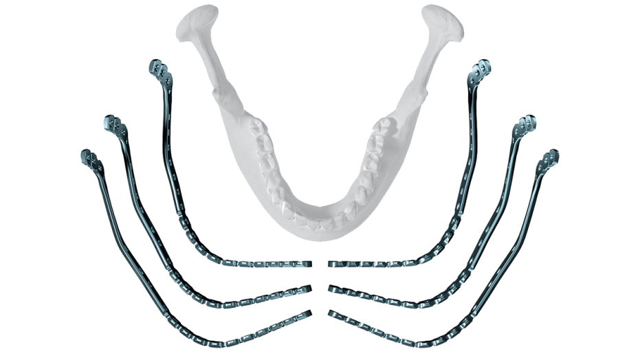 MatrixMANDIBLETM Preformed Reconstruction Plates