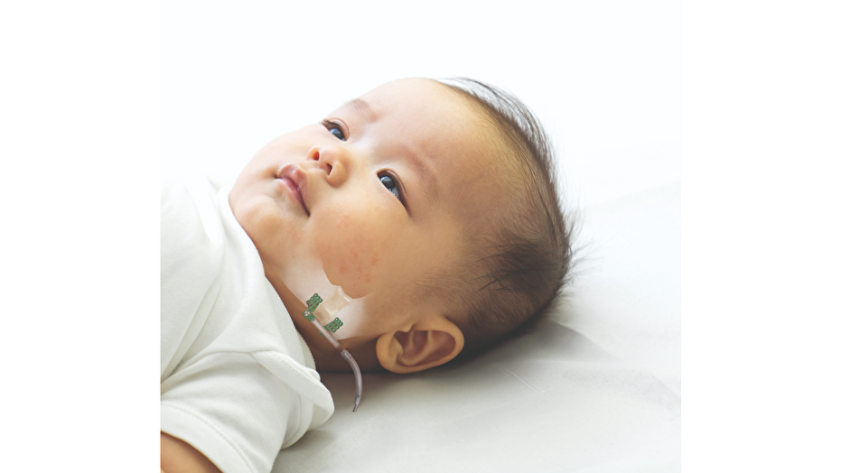 Craniomaxillofacial Distraction System (CMFD)